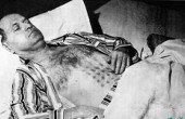 1967年獵鷹湖事件加拿大男子觸摸“UFO”后飽受折磨，真實UFO事件